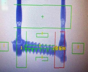 保險(xiǎn)絲焊接缺陷檢測